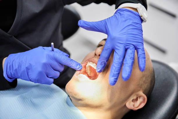 Best Emergency Denture Repair in Troy, OH