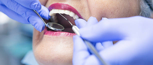 Best Urgent Care for Lost Fillings or Crowns in Troy, OH